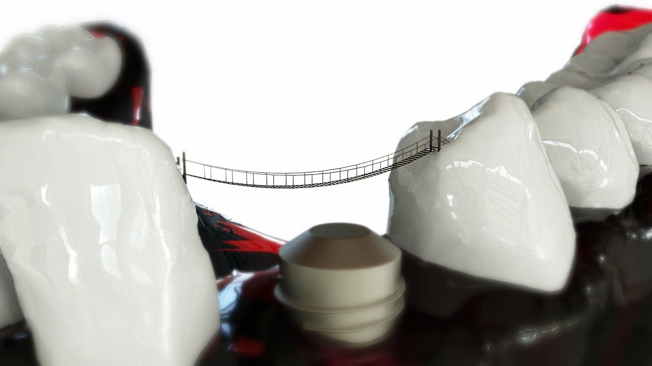 teeth, jaw, 3d model-2833421.jpg